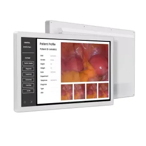 1000nits 27 32 55 inch Endoscopic Gastrointestinal Endoscopic Laparoscopic Surgery DICOM 4k Radiology Diagnostic Medical Monitor