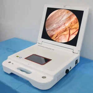 17 Inch HD Portable Medical Endoscope Camera System for ENT Endoscope Portable Rigid Laryngoscope Endoscope
