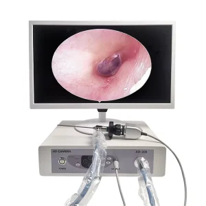 21.5-Inch HD Visual Ear Cleaning Endoscope LED Illumination Pet Medical ENT Inspection Multifunction Industrial Pipeline Quality