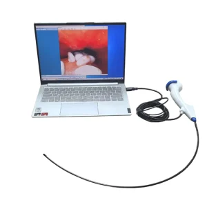 Durable Reusable Ureteroscope Endoscope Medical Flexible Bronchoscope Veterinary Endoscope