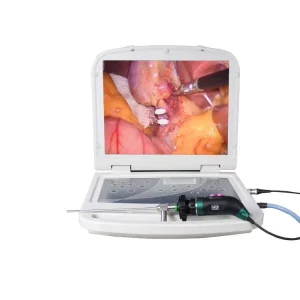 HD Portable Endoscope Medical Endoscope Camera System Video Processing System Endoscope Camera Module for ENT