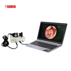 HD Portable USB ENT Endoscopy Set Laptop Endoscope Camera