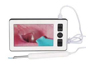 Handheld Visual ENT Endoscope