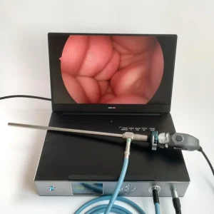 Portable Endoscope Camera System All in One HD Endoscope Camera for ENT Laparoscopy Hysteroscopy Urology