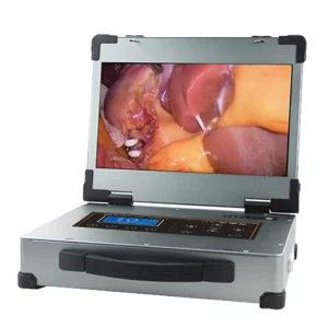 Portable Medical Imaging Endoscope Camera Monitor Endoscopy Equipment