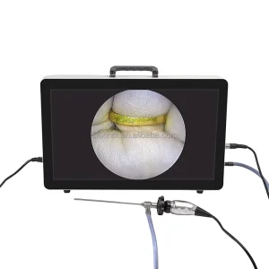 Veterinary 1080P FHD Pet Clinic Portable Endoscope Camera System with LED Light for ENT Urology Gynecology Surgery Equipment