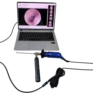 Visual Ear Cleaning USB Cold Light Source 3mm HD LED Industrial Endoscope Animal Ear Nasal Cavity Examination 90